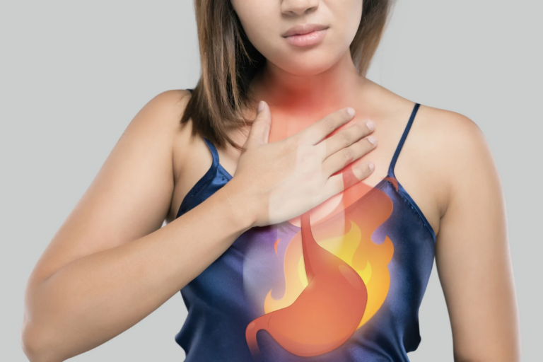 reflux